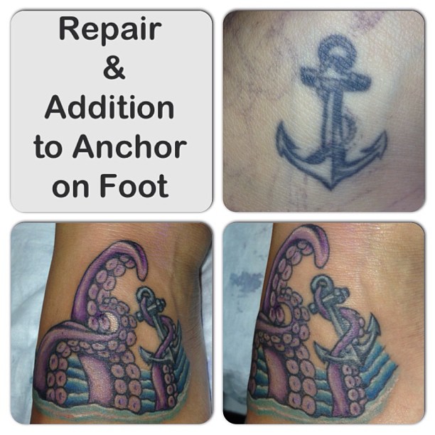 Repair & addition to anchor on foot 
